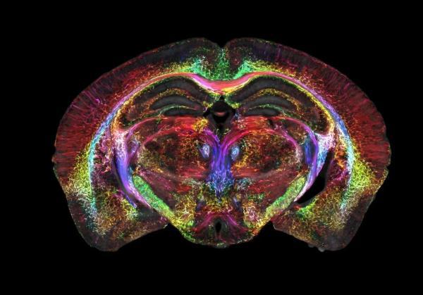 ثبت واضح ترین عکسی که از مغز دیده اید، عکس
