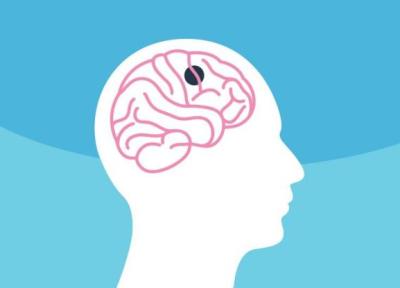 سردرد ناشی از تومور مغزی چگونه است؟